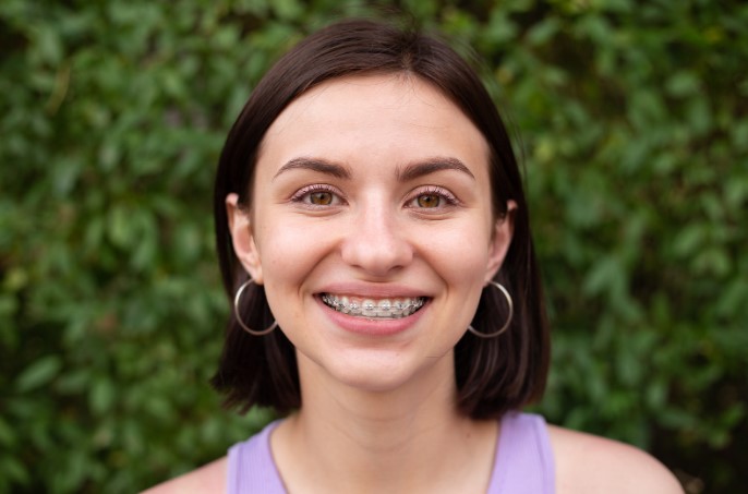 продолжительность ношения брекетов